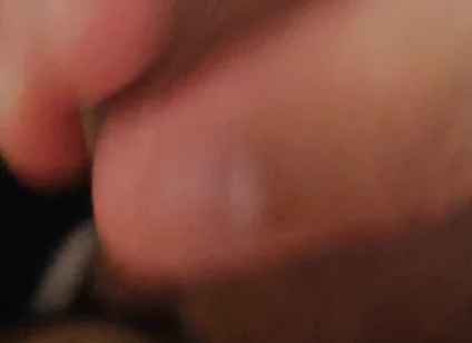 Immense Phimosis Being Extracted Cum and Précum.