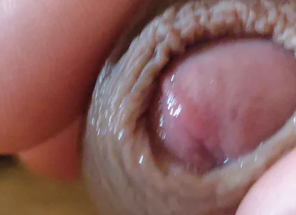 Large Foreskin and Balls in Striking Close-up.