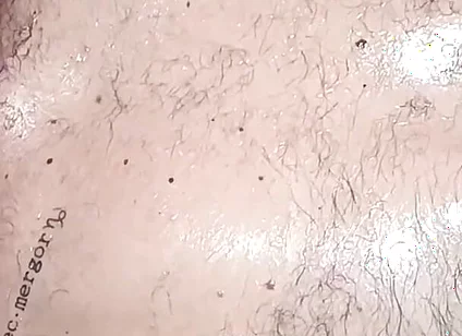 Stillness and Skin