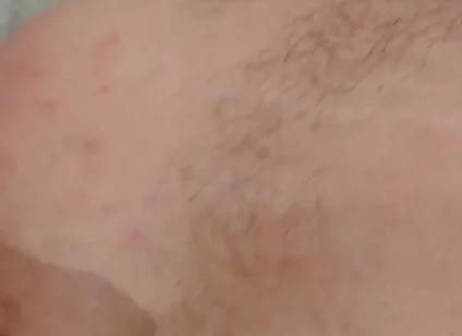 Masturbation