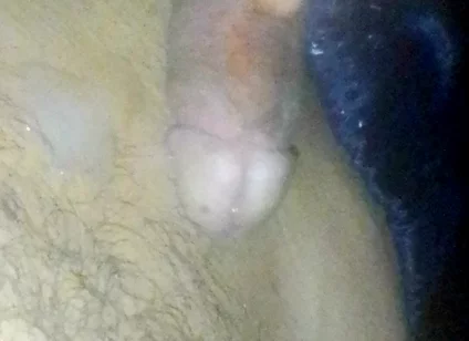 Boy Roasts His Straw and Smears It All Over His Stomach at Night While His Parents Are Away