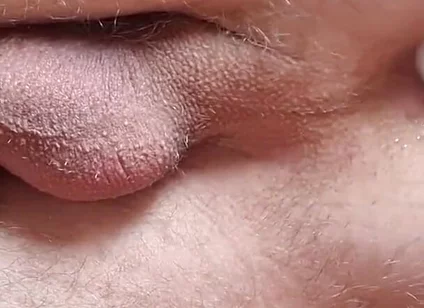Prostate Play 1