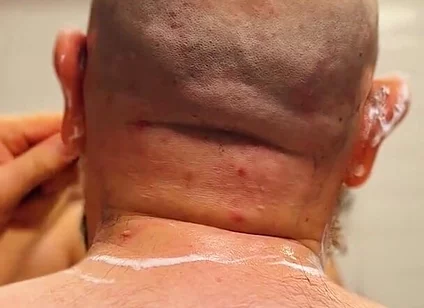 Shave Bald Head and Worship