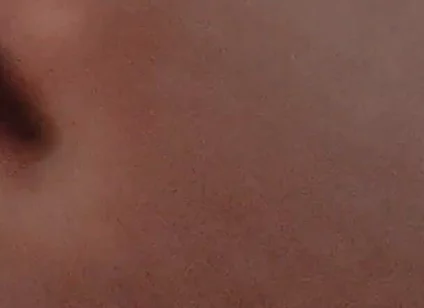 Amazing Closeup of the Widened Hole!!