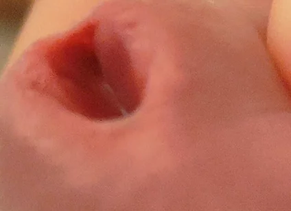 Amazing Closeup of the Widened Hole!!