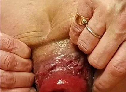 Live Anal Dilation Exercise on Cam to Make You Cum