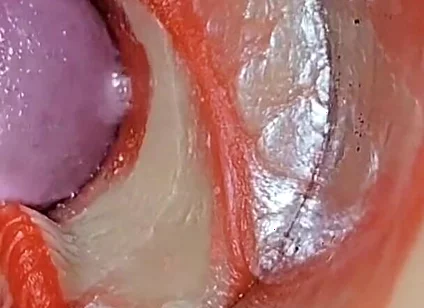 Compilation Creampie Part 2 POV