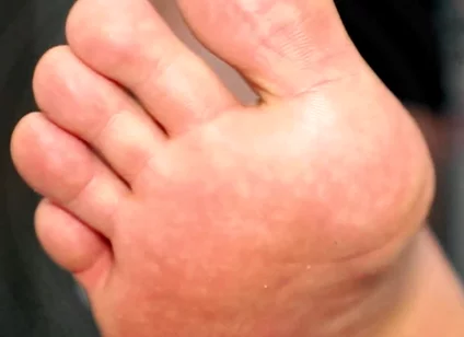 Golden Foot Bath for Pigs
