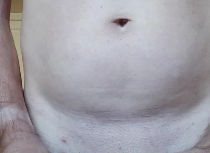 Dilatator