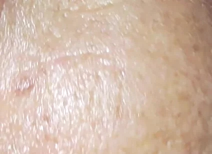 Milk Bath