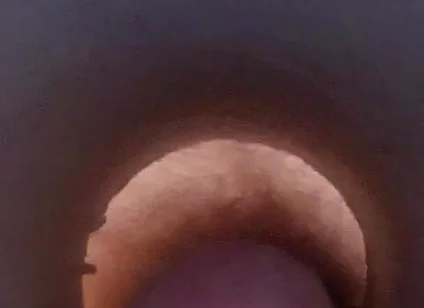 Tunnel Vision