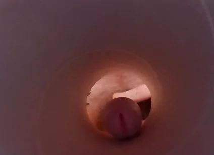 Tunnel Vision