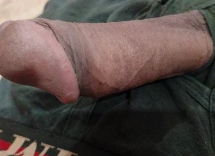 It's so Huge and Tasty.... It's Only for... It's Available for....who Want to Take It