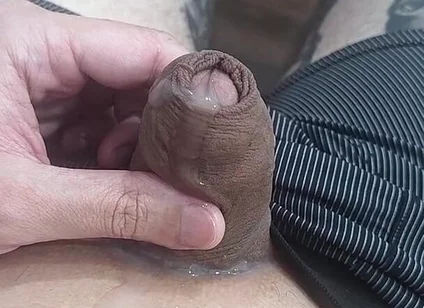 My Penis Won't Stop Spitting Semen