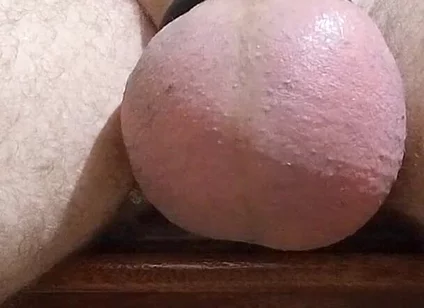 Saline and Masturbation