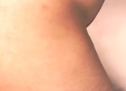 Smooth Skin