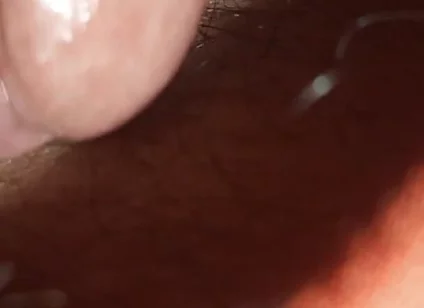 Super Anal