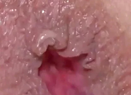 Extreme Closeup Dildo Anal Creampie