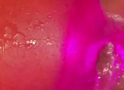 What a Blow Hole