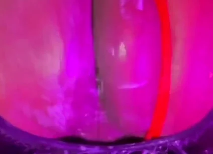 Why Yo Butt so Big?