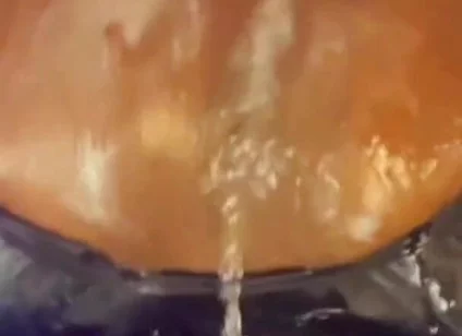 Creampie Ejector