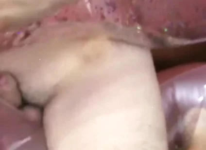 Inflatable lips