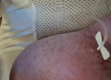 Extreme Fillings Inside My Siliconemeat