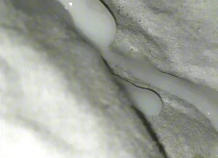 Huge Sperms Out of His Penis, an Young Boy