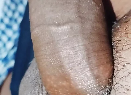 Penis