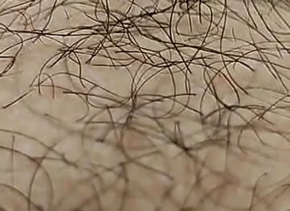 I'm Hairy Boy This My Legs and Dick
