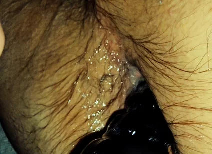 Training My Sloppy Hole