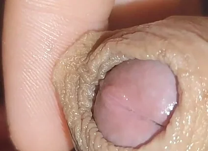 24 Hours of Exhausted Uncontrollable Erection