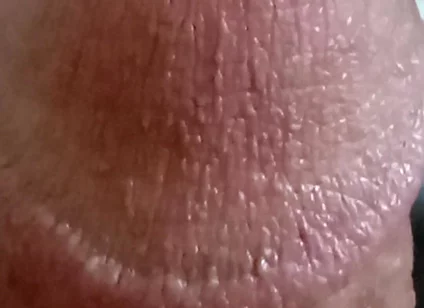 My Dick