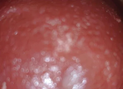 Deep Thrusts Trigger Feverish Cum Inside Without Sperm's Trace
