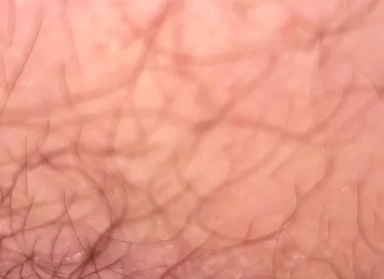 Close up Hairy Hole