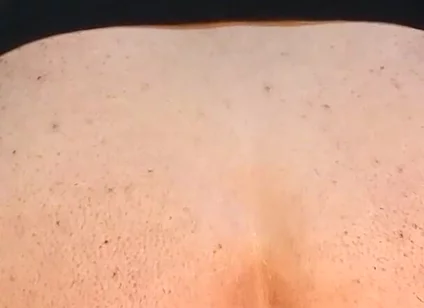 He Enjoys Sucking on His Anal Prolapse