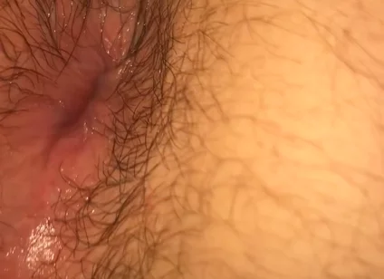 Hairy Twink Hole