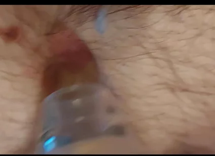 A Close-up Shot of My Belly Button as I Play with It