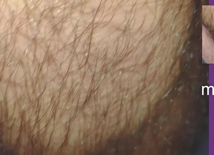 The Texture of the Clothes