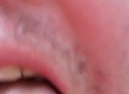 Camera Blunder in the Attempt at Facial Insemination