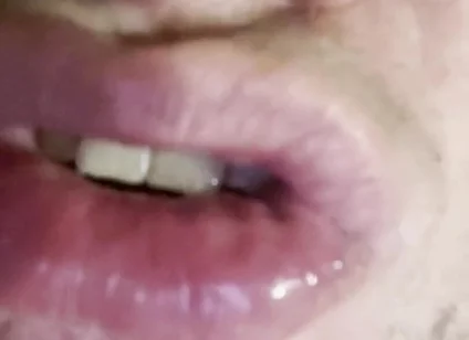 Mad for Tongue
