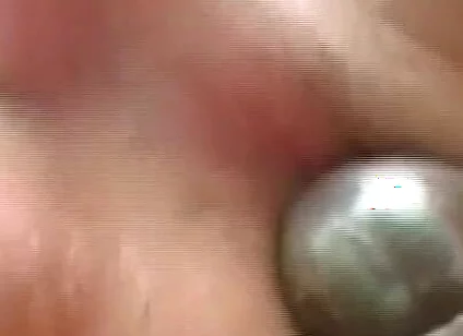 Gaping Anal Rosebud Prolapsing After Deep Stretching Session