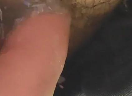Uncircumcised Phimosis Has the First Ejaculation.