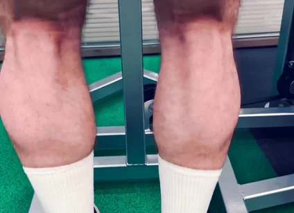My Legs