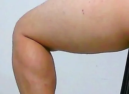 Oh, My Ass Hurts, Apply Ointment