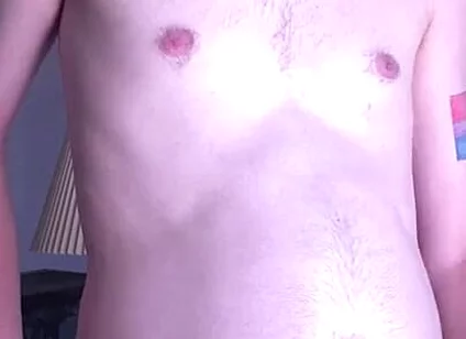 Young Mans Belly Turns Into a Orb