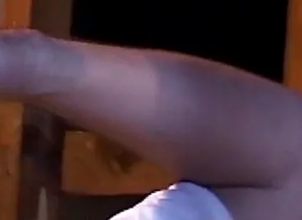 Skater Bottom's Rough Treatment