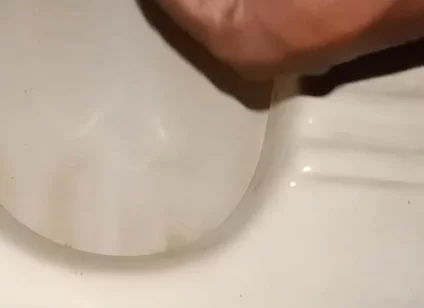Urinating From the Penis