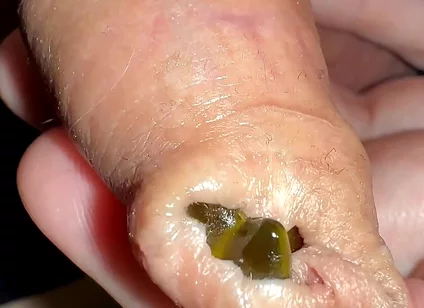 Juicy Small Cock Foreskin Games