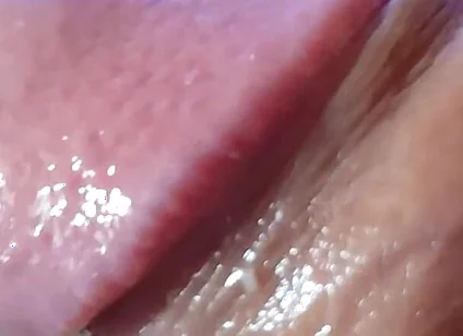 Strange Lumpy Cock with a Gigantic Head.